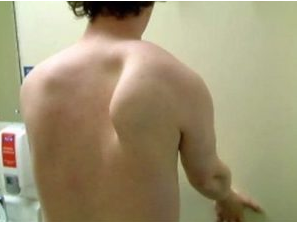 Last month’s Inner Circle webinar was on 5 Tips for Treating Scapular Winging. at Tenlibrary.com