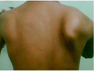 The numerous muscles that attach to the shoulder blade at Tenlibrary.com